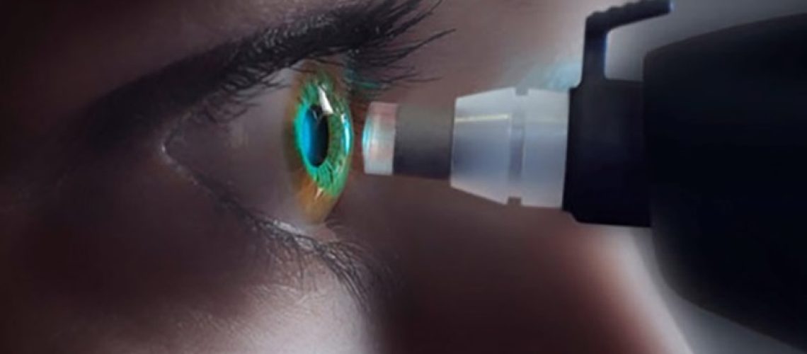 دکتر گونیوسکوپی